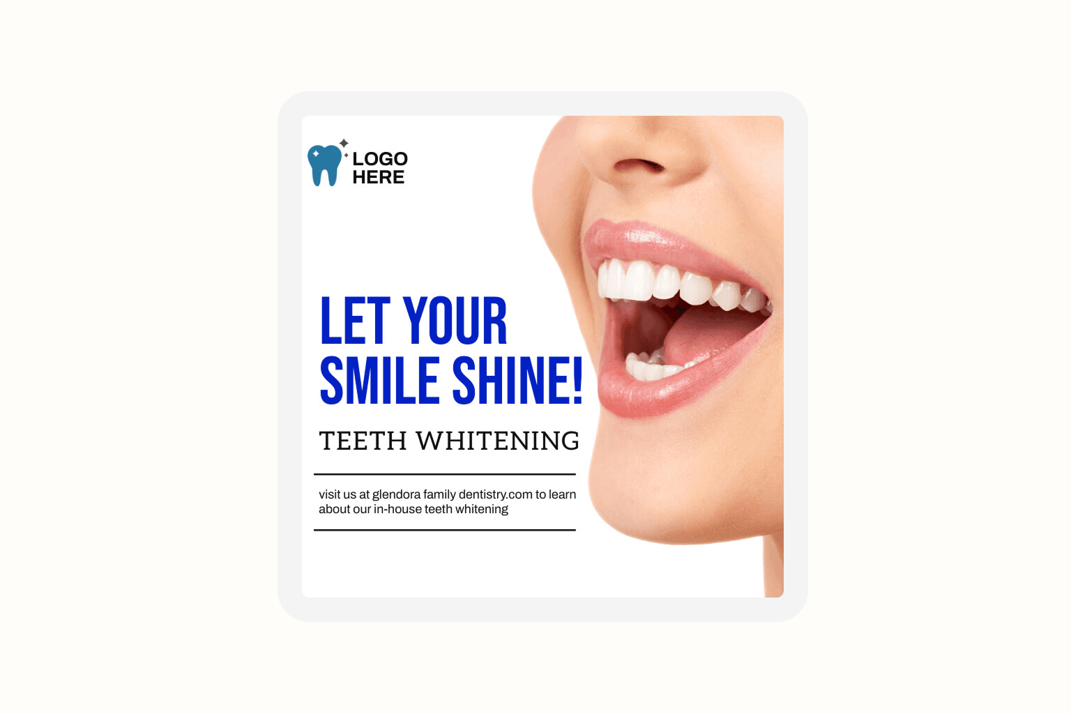 ad example for teeth whitening
